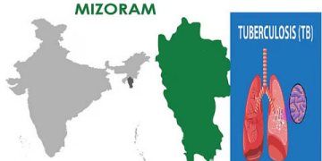 145 people died of TB in Mizoram, highest in 6 years